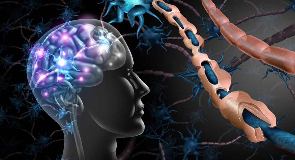 Holistic therapy of breast cancer – Autoimmune diseases – Borrelia – Lyme 1, 2 and Demonstration with Eductor