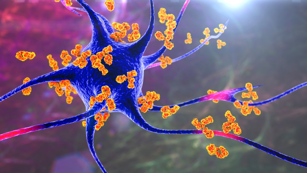 Inflammation, Autoimmumity and Degeneration… How to Decode the Matrix to Resolve your most Challenging Cases