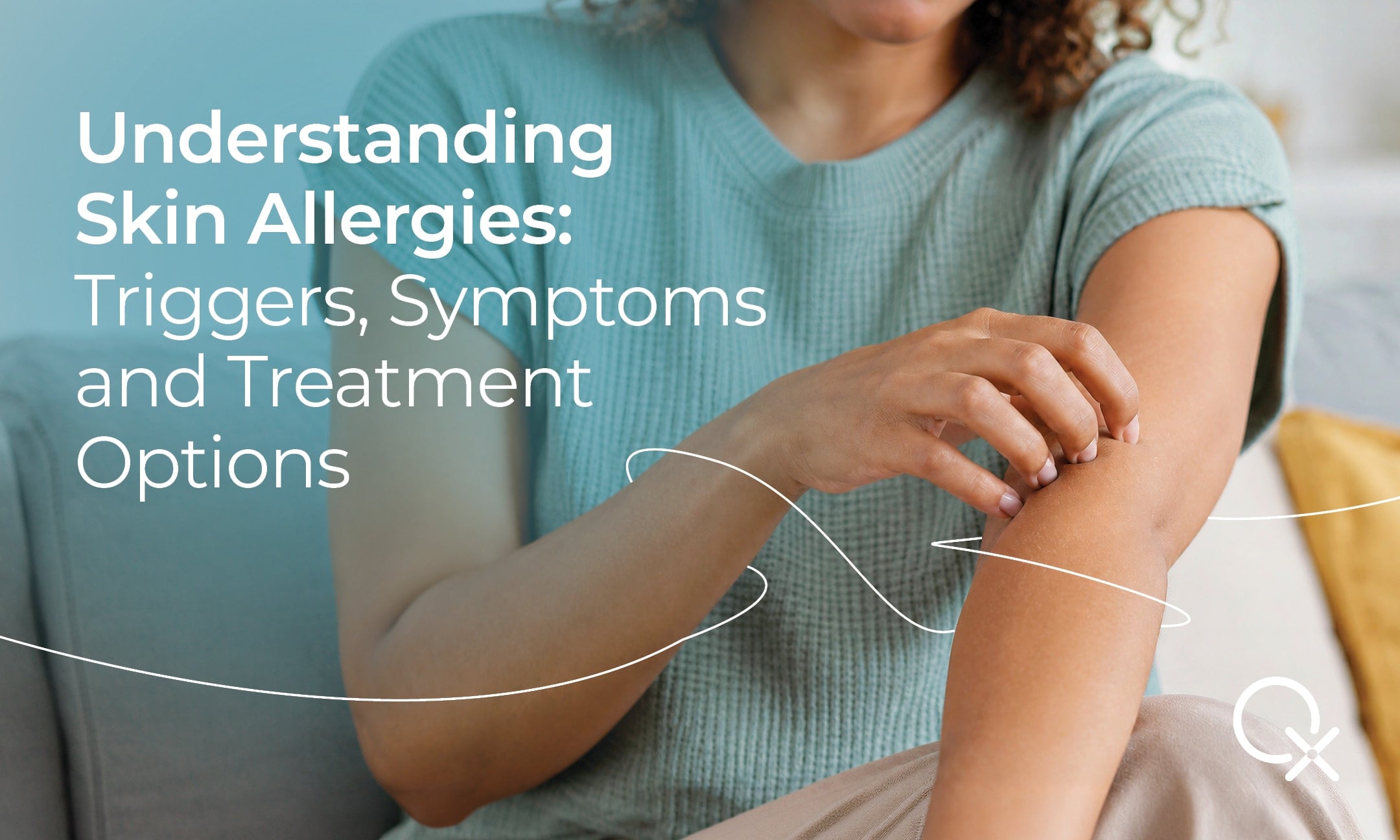 Contact dermatitis causing redness and irritation on the hand