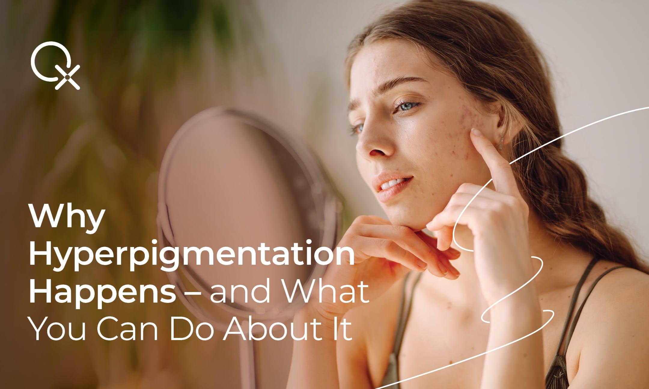 Common causes of hyperpigmentation including sun exposure, hormones, and skin inflammation